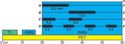 Dissecting Motor and Cognitive Component Processes of a Finger-Tapping Task With Hybrid Dopamine Positron Emission Tomography and Functional Magnetic Resonance Imaging